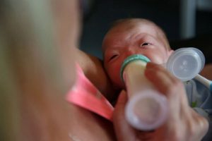 Bebé milagre nasce sem nariz, mas a história dele está a encantar o Mundo