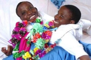 Siamesas da Tanzânia morrem aos 21 anos [vídeo]