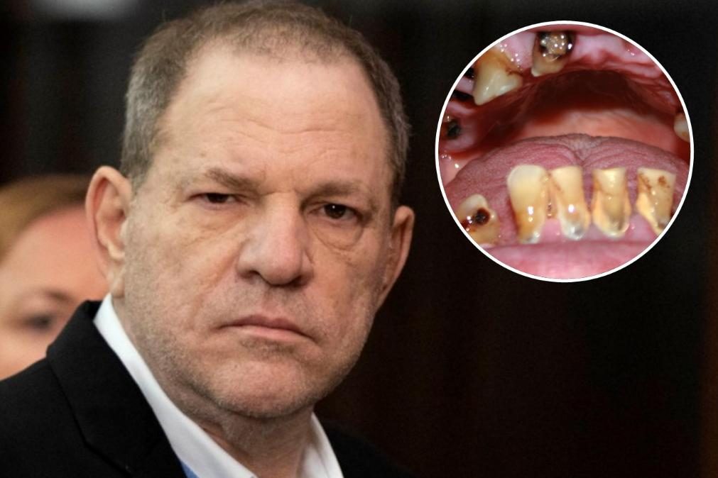 Harvey Weinstein implora que dentista lhe pare de arrancar dentes
