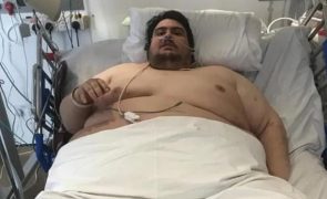 Homem de 298 quilos acusa médicas de não o deixarem beber refrigerantes