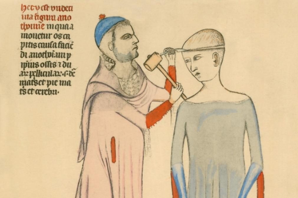 Sete costumes medievais bizarros que roçam a tortura