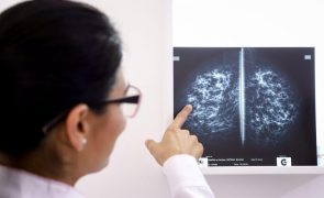 Estudo europeu para detetar risco de cancro da mama em mulheres jovens abrange hospital de Lisboa
