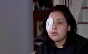 Adolescente perde olho após proteger menino vítima de bullying [vídeo]