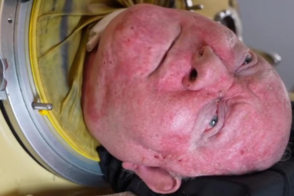 Paul Alexander: O último homem que vive com um pulmão de ferro