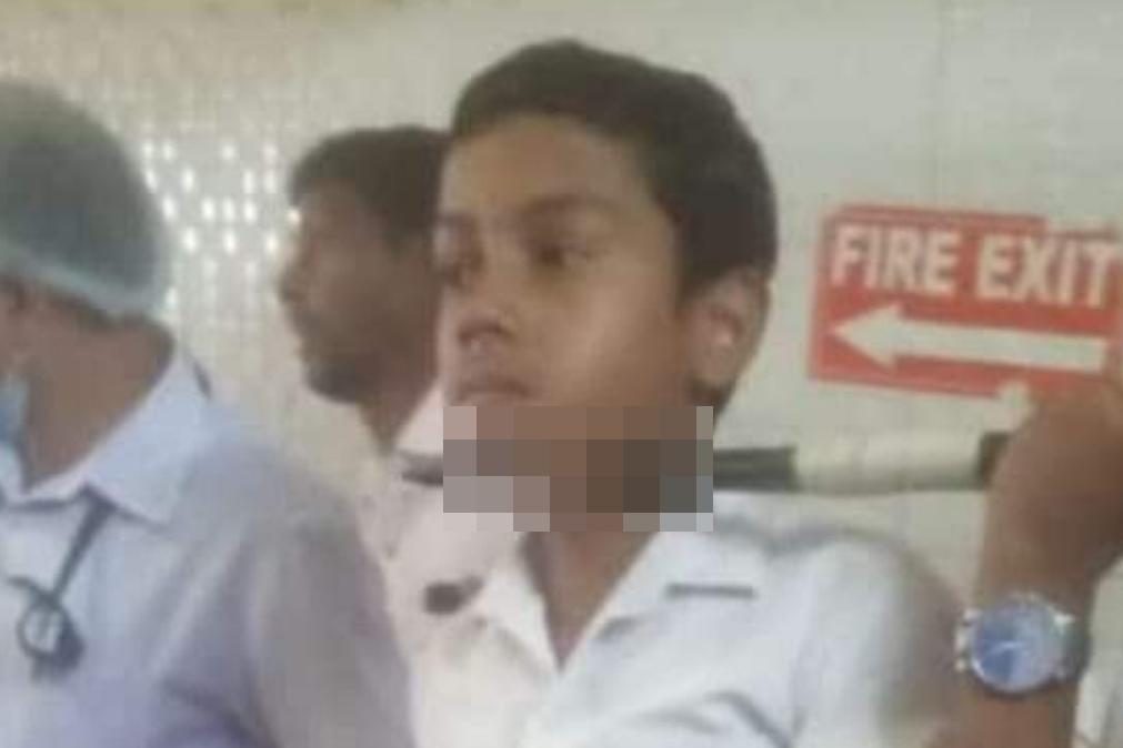 Adolescente empalado por dardo na escola [imagens sensíveis]