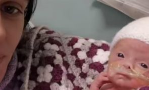 Bebé nasce às 24 semanas depois de dado como morto no útero