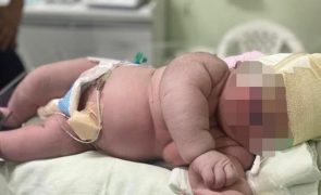 Bebé gigante nasce com 59 centímetros e mais de sete quilos