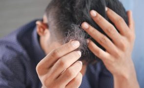 Consumo diário de refrigerantes aumenta risco de queda de cabelo em mais de 50%