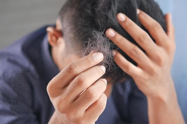 Consumo diário de refrigerantes aumenta risco de queda de cabelo em mais de 50%