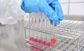 Cientistas desenvolvem método de monitorização do cancro da bexiga a partir de análise à urina