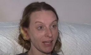 Macaco de estimação desfaz orelha de mulher: 