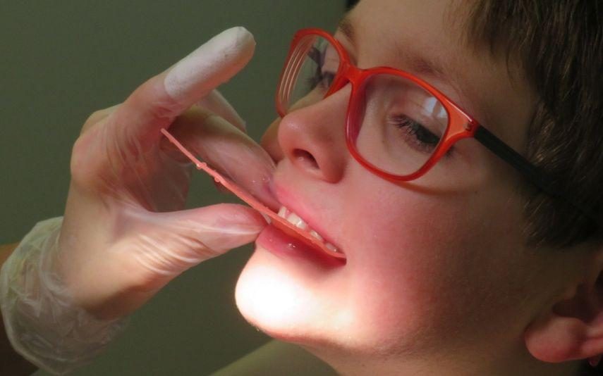 Aparelho dentário - Alimentos a evitar e precauções a ter!