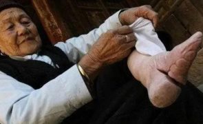 Pés de lótus: A extrema tradição chinesa para tornar as mulheres 