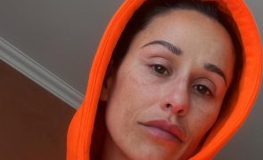 Rita Pereira foi diagnosticada com preocupante problema na coluna