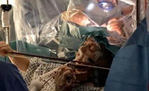 Mulher toca violino durante operação enquanto lhe retiram tumor cerebral