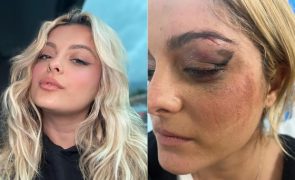 Bebe Rexha - Fã explica agressão a cantora: “Achei que poderia ser divertido”