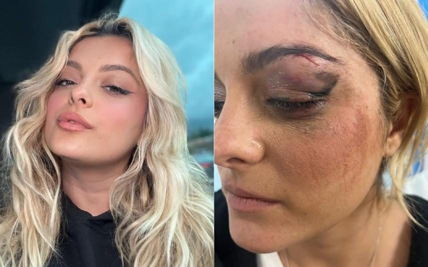 Bebe Rexha - Fã explica agressão a cantora: “Achei que poderia ser divertido”
