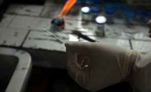 Portugal regista 1.584 casos de tuberculose em 2023, maior incidência em Lisboa e Norte