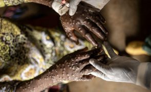 África registou 111.291 casos de mpox e 1.724 mortes desde janeiro 2024