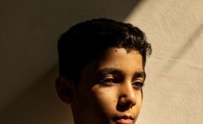 Guerra de Gaza na fotografia do ano do World Press Photo com menino palestiniano mutilado