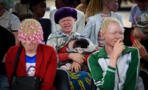 Cancro da pele continua a fazer vítimas entre albinos em Angola por falta de apoios - Associação