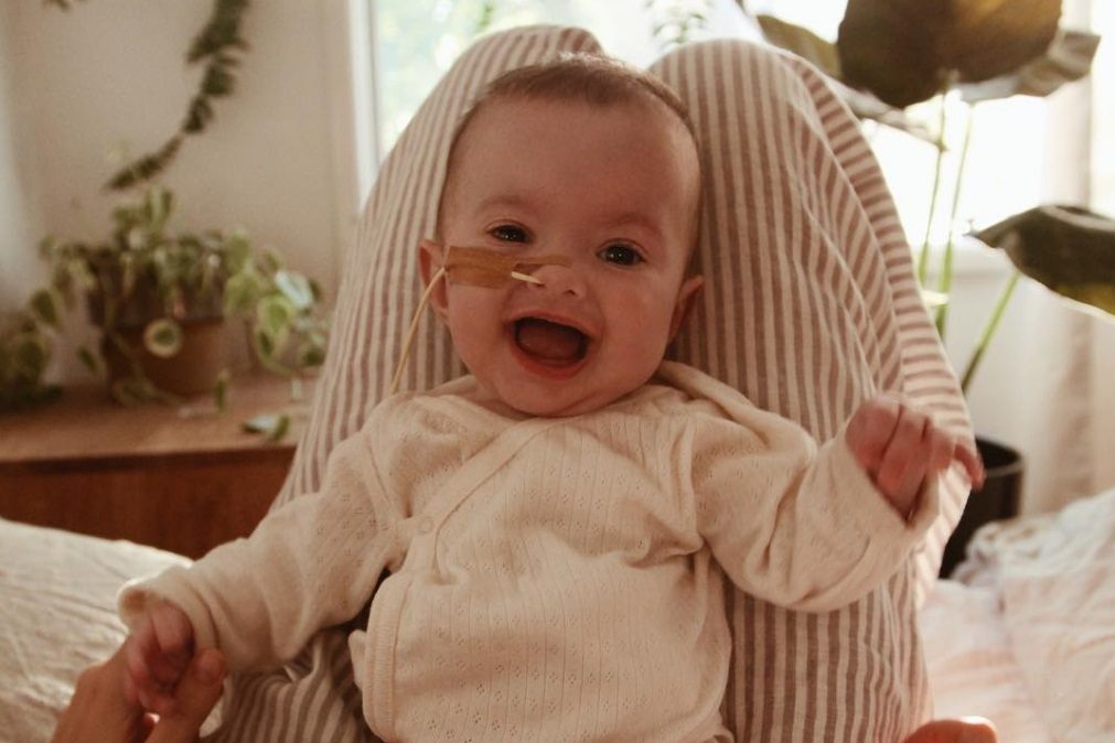 A história de Jessica Stein, a blogger que é mãe de uma bebé com doença raríssima