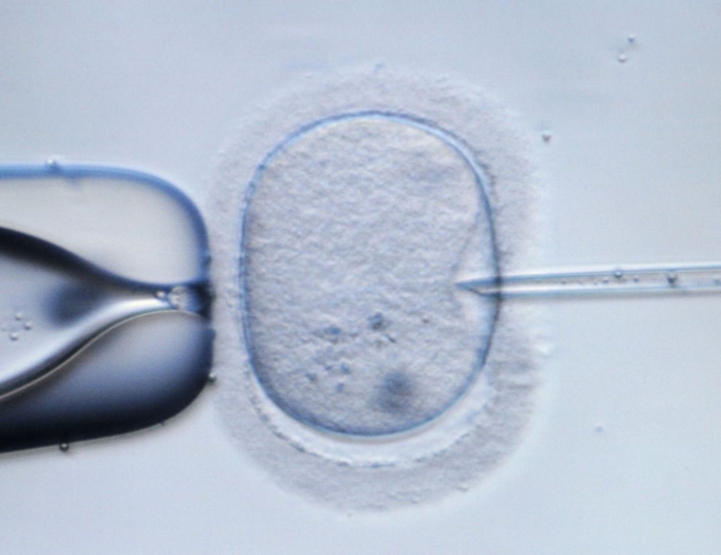 Cientistas desenvolvem óvulos humanos pela primeira vez