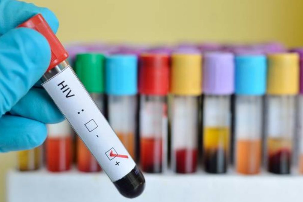 Nova vacina contra o VIH apresenta bons resultados
