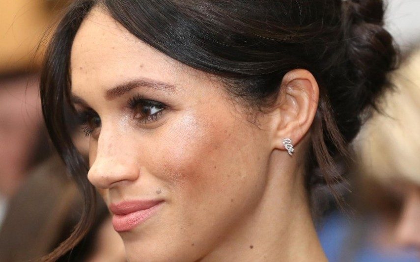 As plásticas, os procedimentos e retoques de Meghan Markle