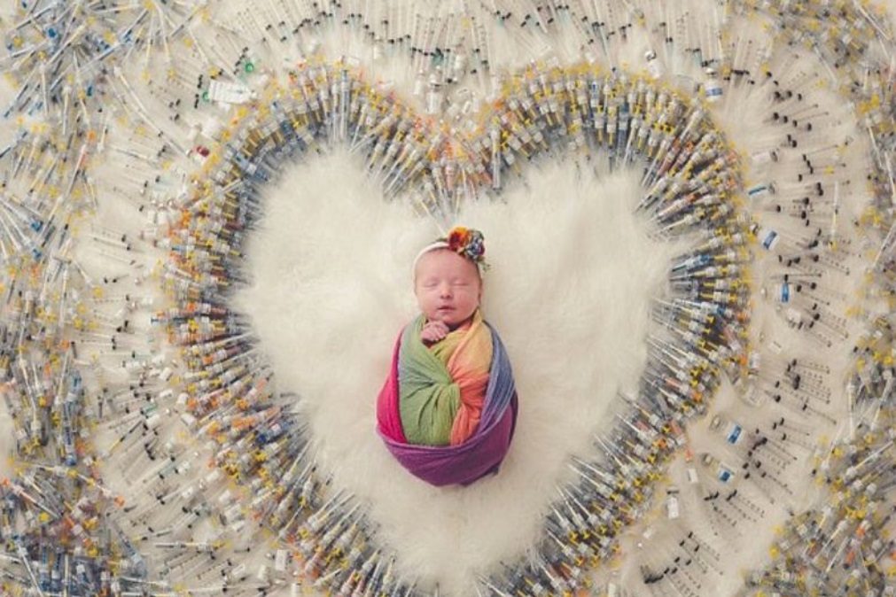 Mães partilham foto da bebé com as 1616 agulhas que usaram em tratamentos de fertilidade