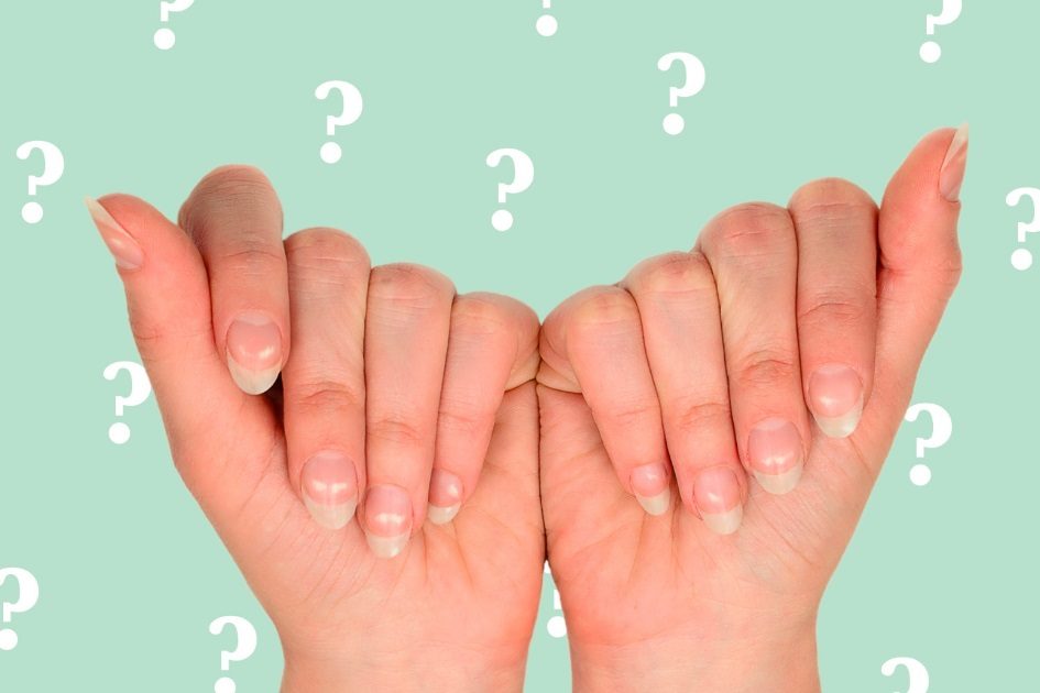 Tem manchas brancas nas unhas? Saiba o que significam