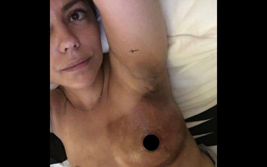 «Quem procura cura». Sofia Ribeiro mostra peito durante o cancro