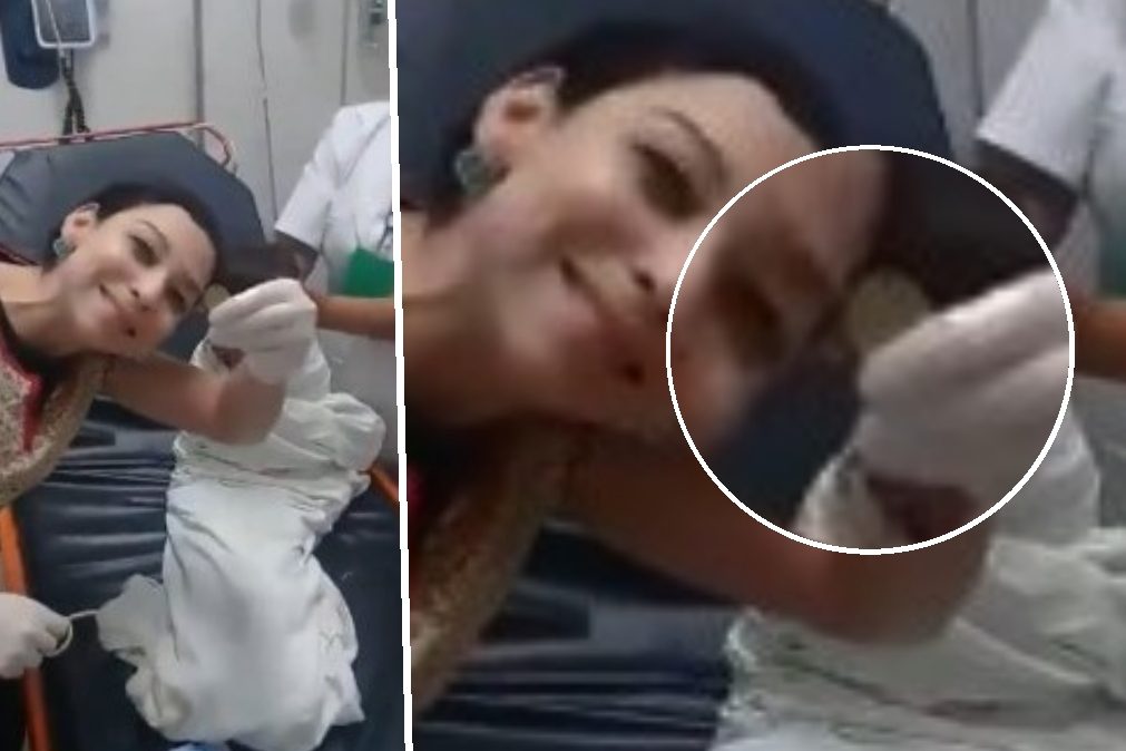 Médica extrai moeda ingerida por menino e vídeo torna-se viral