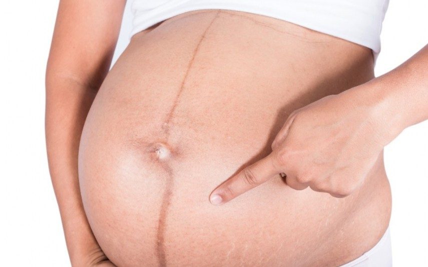 Saiba por que aparece uma linha escura na barriga das grávidas