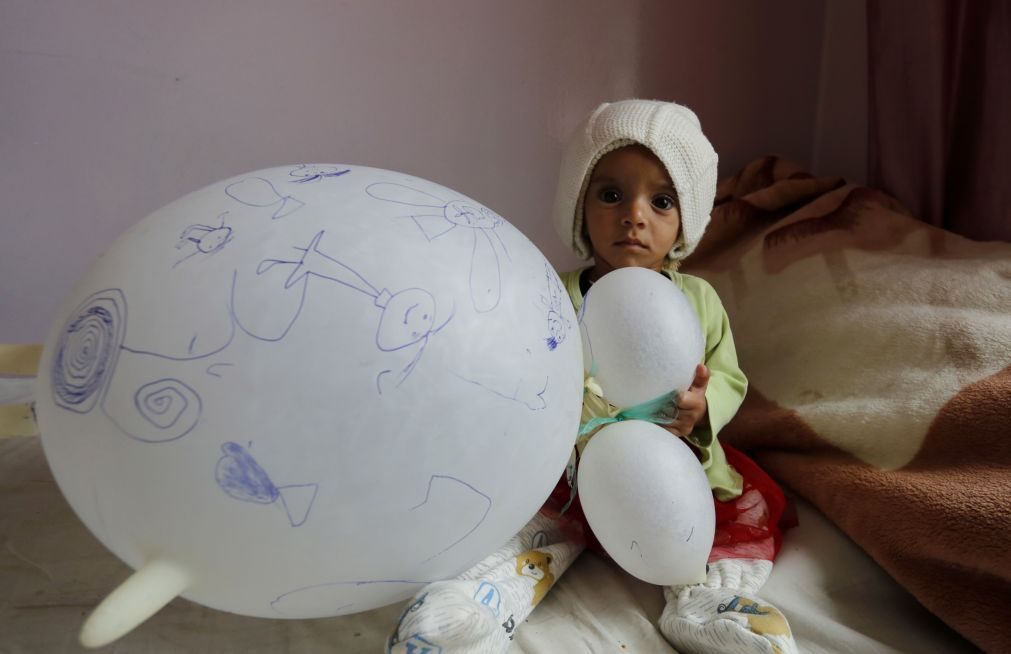 Cerca de 20 milhões de pessoas no Iémen estão famintas, diz ONU