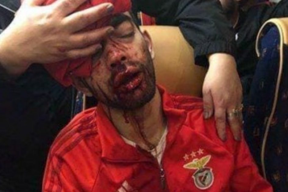 Ataque ao autocarro de adeptos de Barcelos do Benfica: «Vivemos momentos de terror»