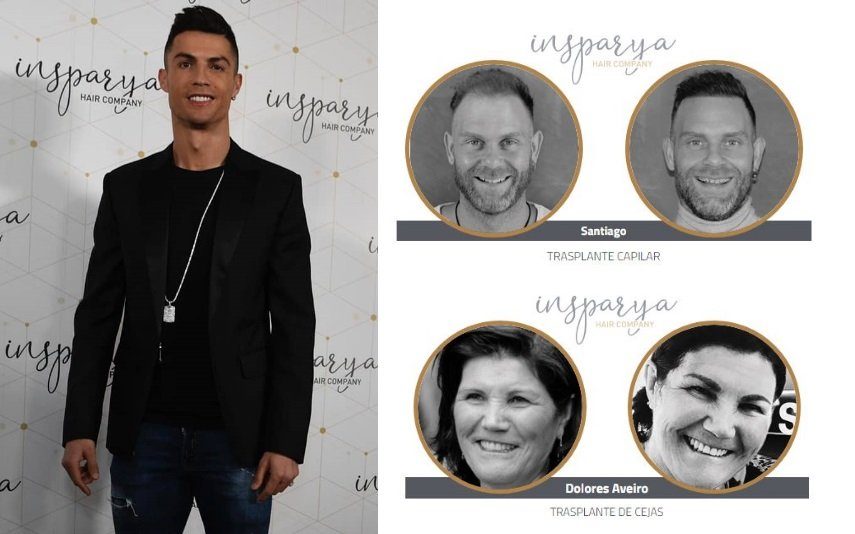 Nem o ex-cunhado de Cristiano Ronaldo resiste aos implantes capilares da clínica