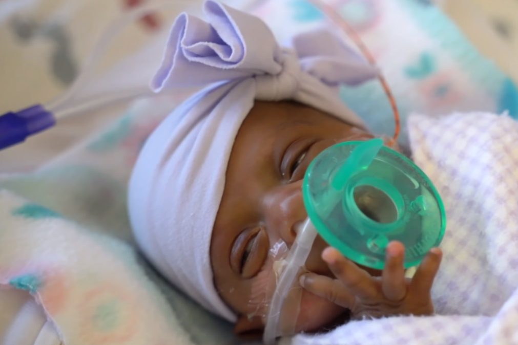 Bebé de 244 gramas nasce em hospital nos EUA