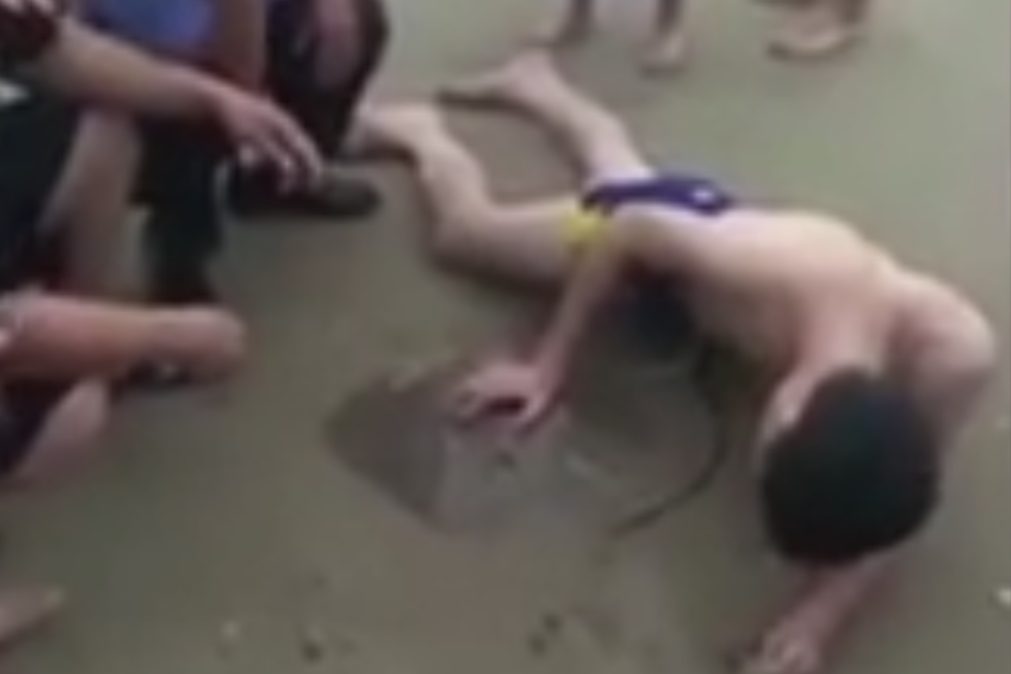 Turista atacado por raia no pénis depois de mergulho na praia [vídeo]