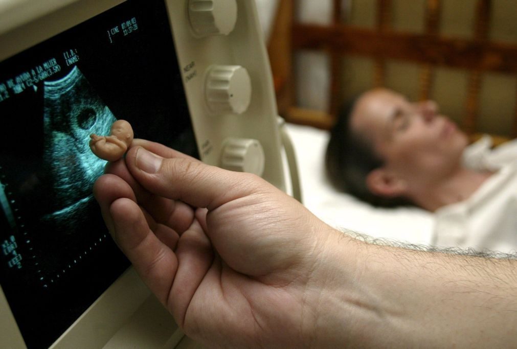 Estudo revela músculos em embriões humanos que se perdem antes de nascer