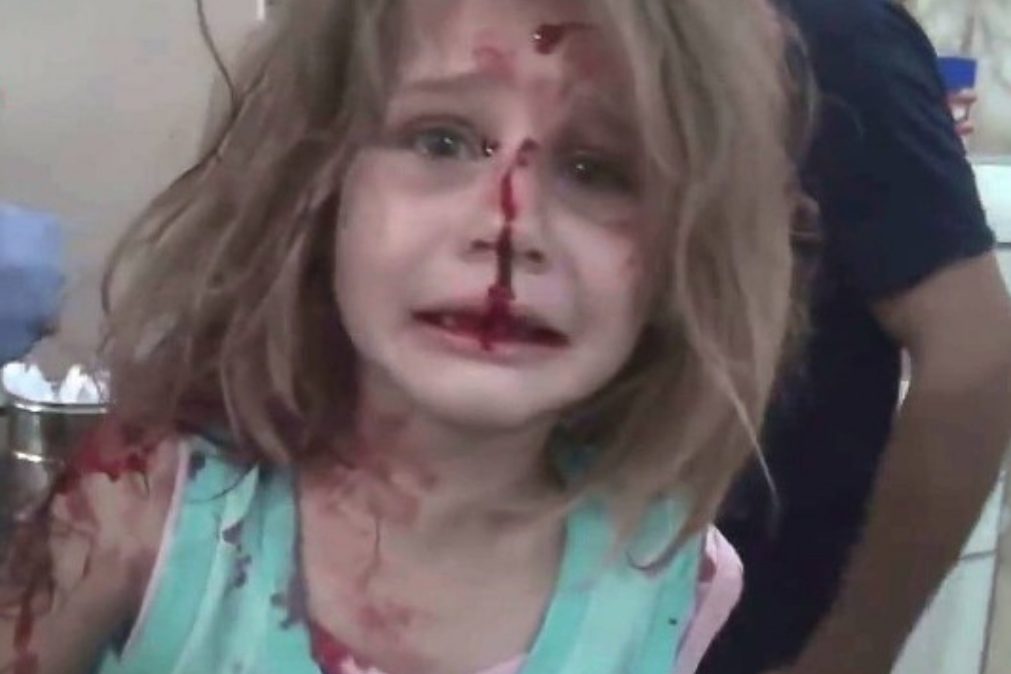Vídeo mostra menina desesperada em busca do pai após bombardeamento na Síria