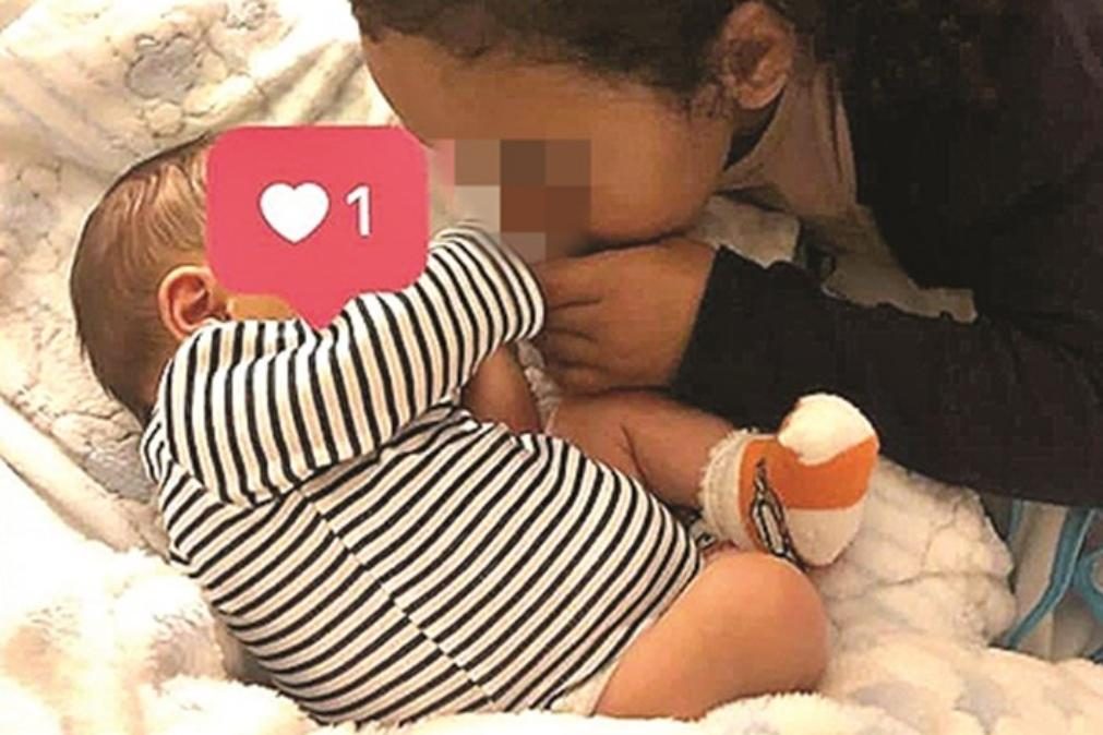 Bebé sem rosto | Obstetra acumula 14 queixas na Ordem dos Médicos