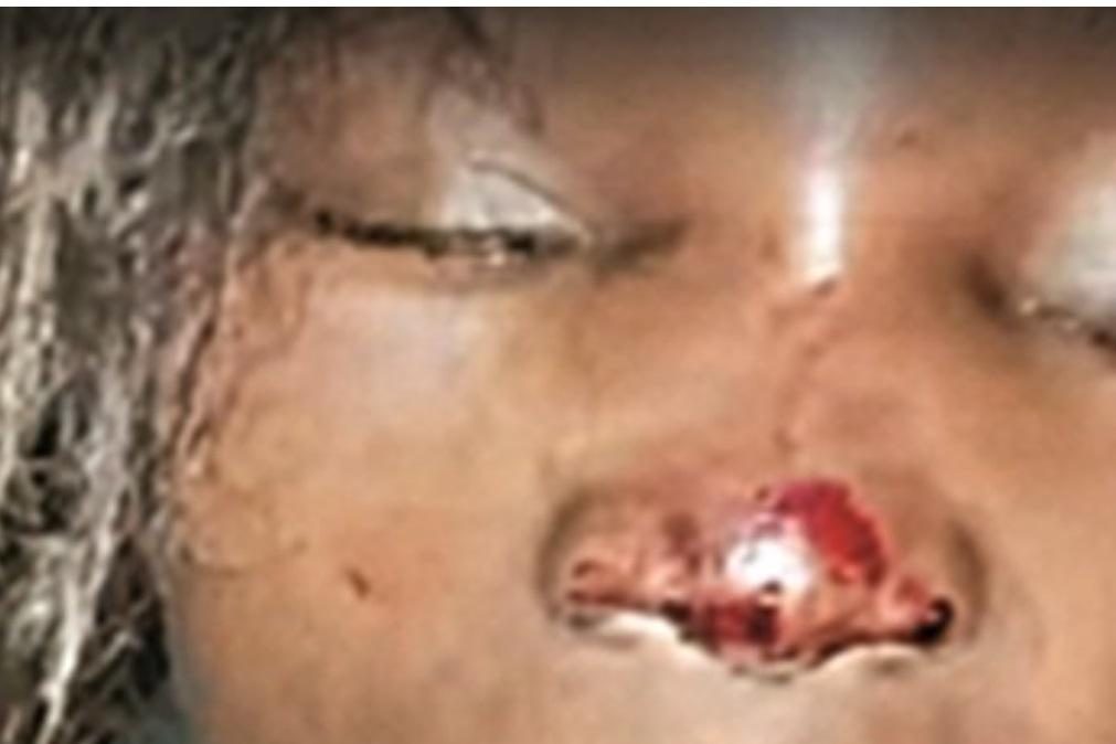 Sindicato da PSP mostra fotos do polícia acusado de espancar mulher negra