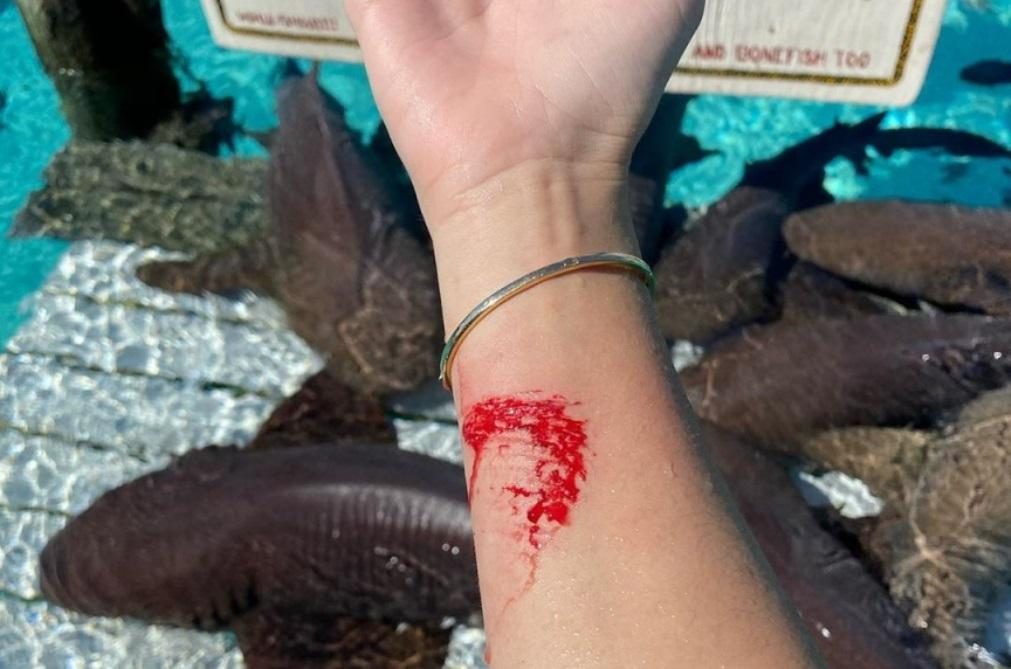 Influencer brasileira mordida por tubarão nas Bahamas