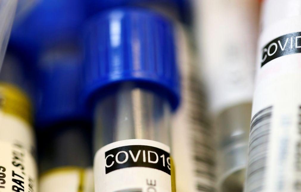 Covid-19: Médicos de Saúde Pública defendem mais testes, incluindo aleatórios