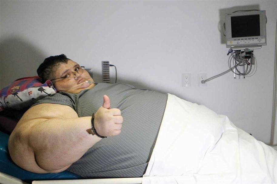 Homem mais gordo do mundo emagrece 170 quilos