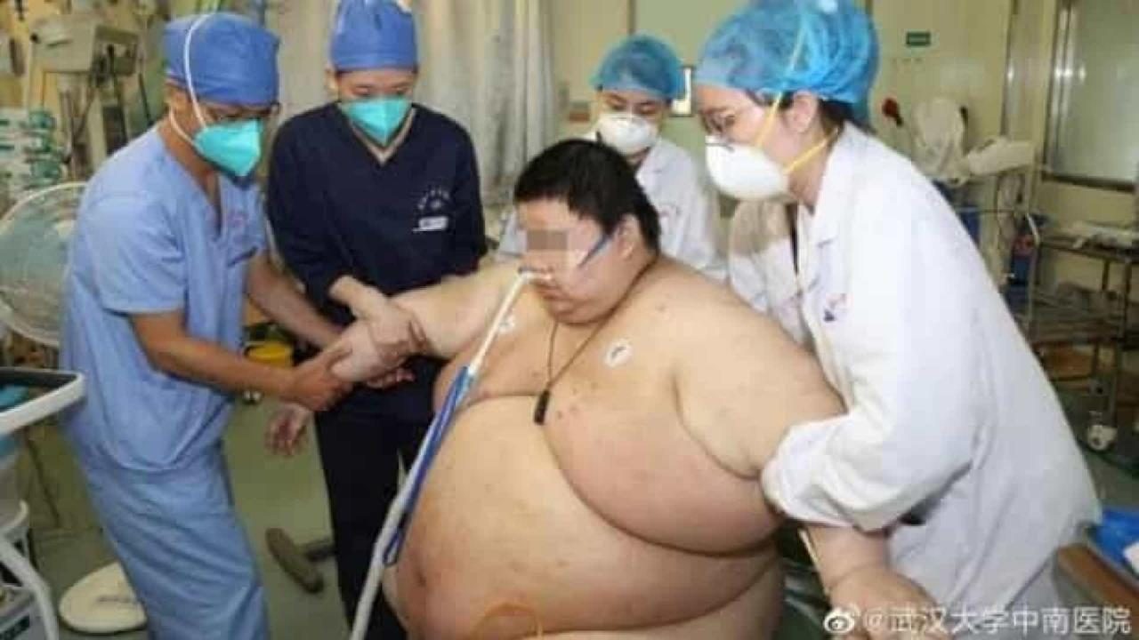 Homem engorda 100 kg durante a quarentena