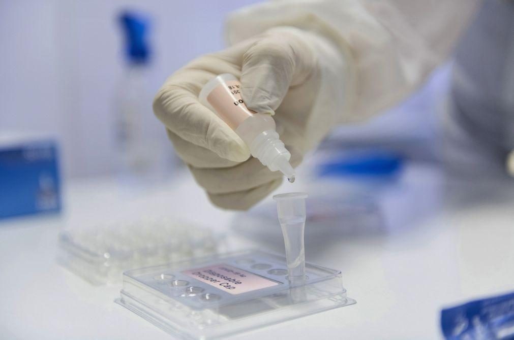 Covid-19: Bruxelas lança materiais de referência que melhoram testes a anticorpos