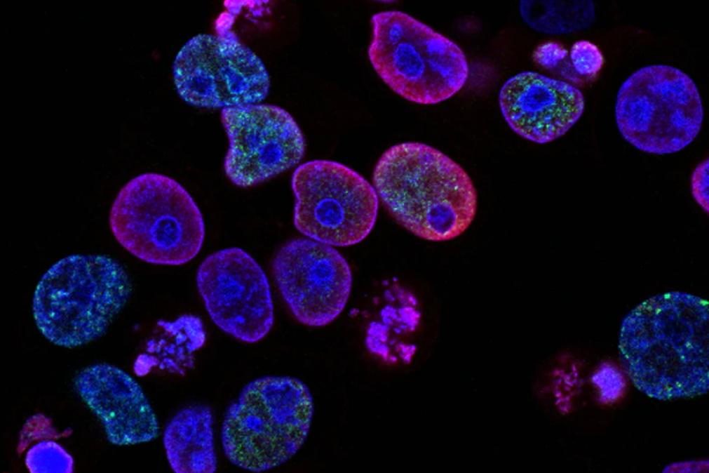 Vírus podem ser «grande ajuda» no tratamento do cancro, conclui estudo