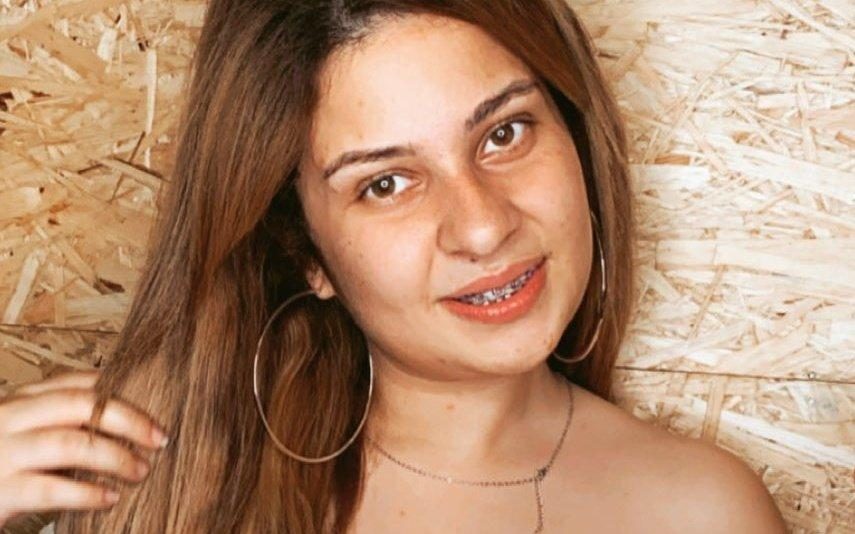 Sandrina Pratas partilha resultado após cirurgia estética ao nariz